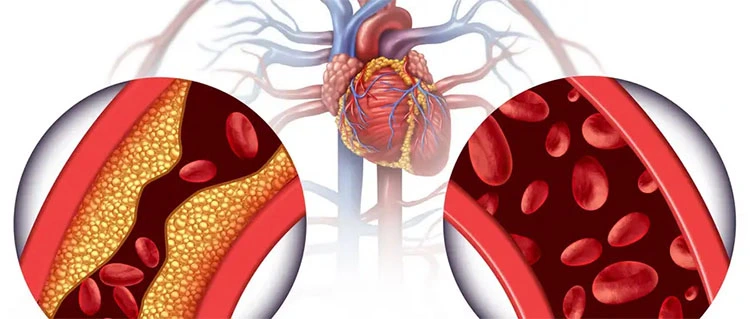 product-1-1 product-1-1