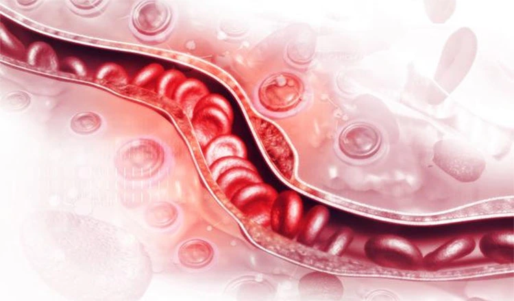 product-1-1 product-1-1